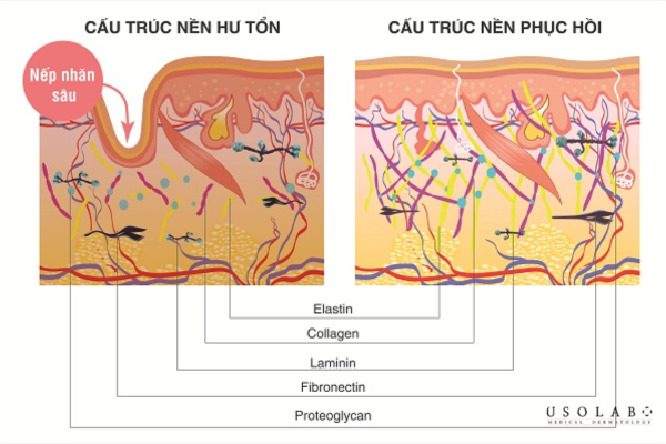 cách phục hồi da sau treatment