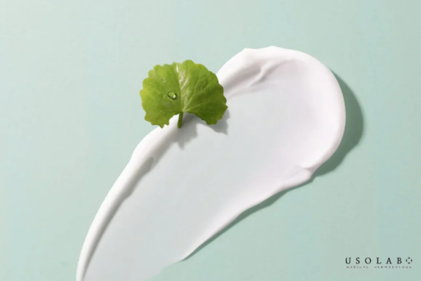 ceramide cho da treatment