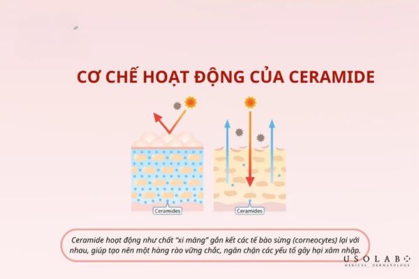 ceramide giảm mất nước