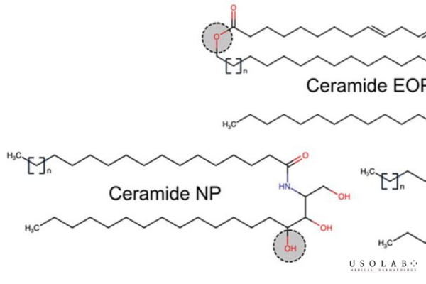 ceramide giảm mất nước