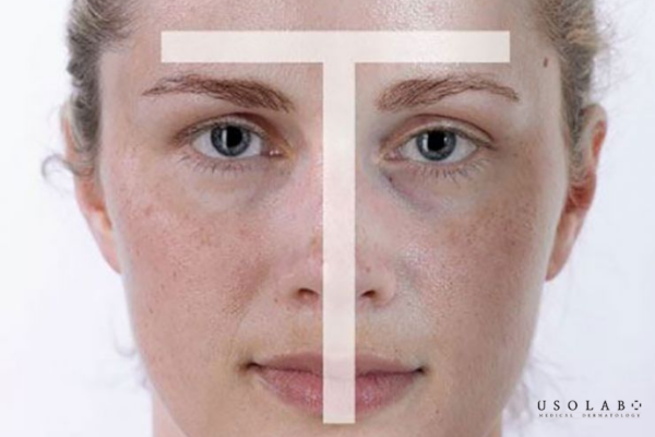 ceramide giảm mất nước