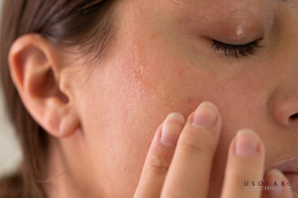 Tại sao da bạn lại thiếu hụt Ceramide và hậu quả là gì?
