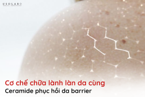 ceramide phục hồi da