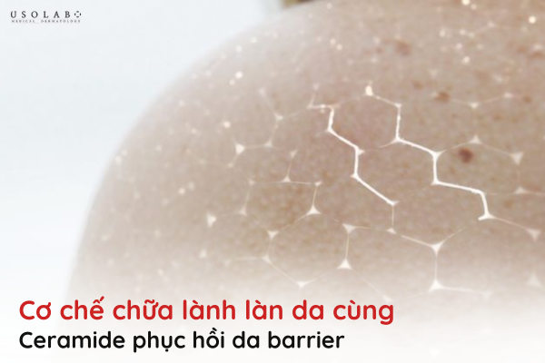 ceramide phục hồi da