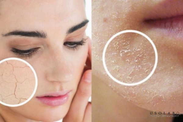 da sau treatment chăm sóc thế nào
