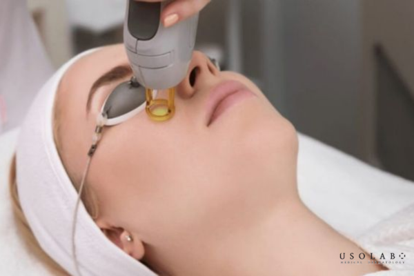 cách làm dịu da đỏ sau laser