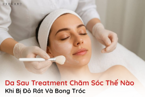 da sau treatment chăm sóc thế nào