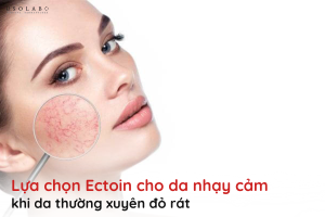 ectoin cho da nhạy cảm