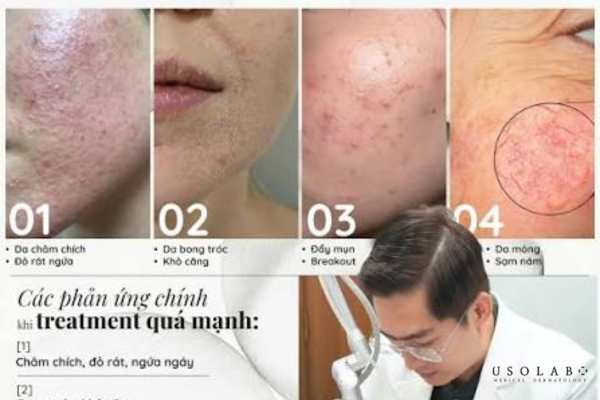 ectoin chống stress môi trường
