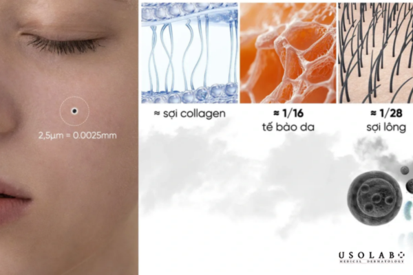 ectoin có tốt không