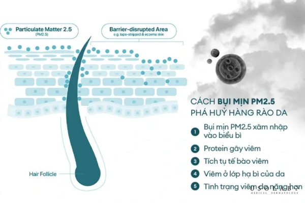 ectoin giảm kích ứng
