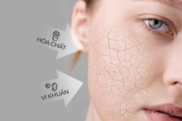 ectoin giảm kích ứng