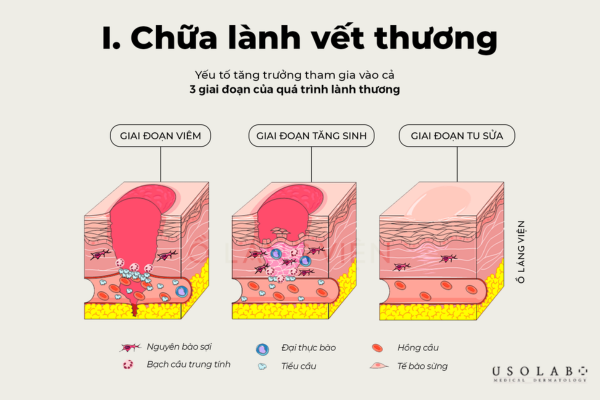 ectoin phục hồi da