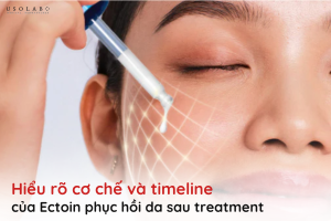 ectoin phục hồi da