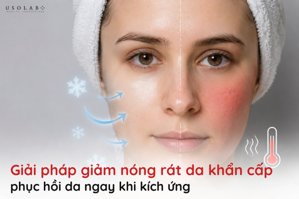 giảm nóng rát da