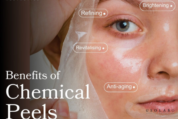 kem phục hồi sau peel