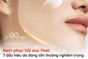 kem phục hồi sau peel