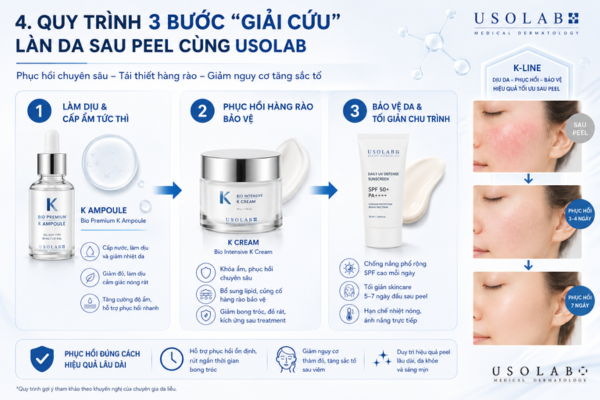kem phục hồi sau peel