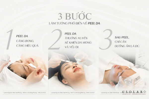 kem phục hồi sau peel