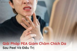 pea giảm châm chích