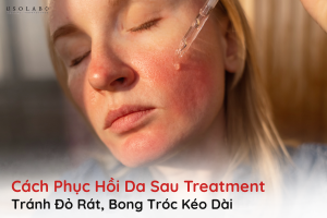 cách phục hồi da sau treatment