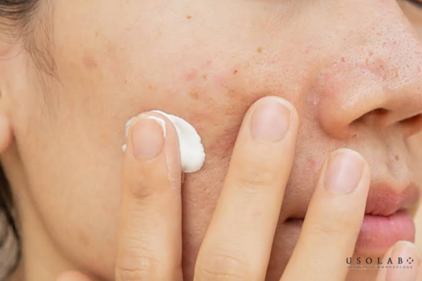 phục hồi da sau xâm lấn