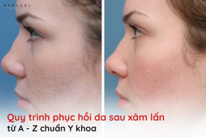 phục hồi da sau xâm lấn
