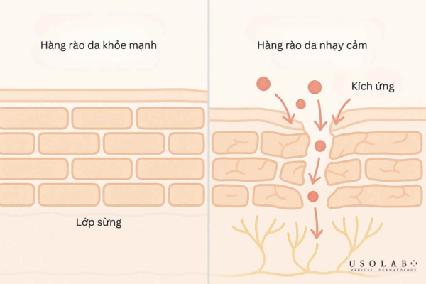 phục hồi thần kinh da