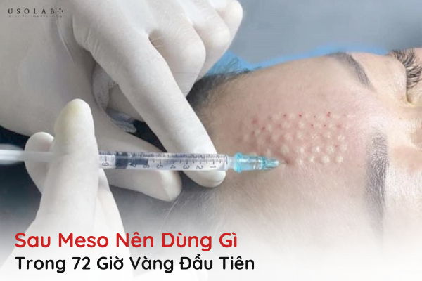 sau meso nên dùng gì