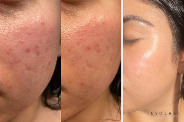 vitamin k có phục hồi vi mạch không