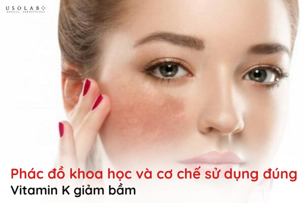 vitamin k giảm bầm