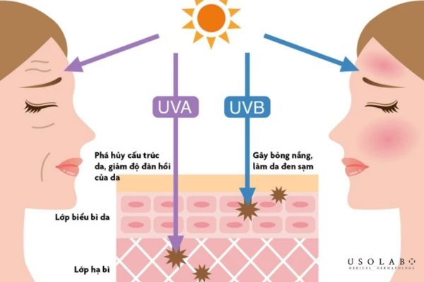 giảm châm chích sau treatment
