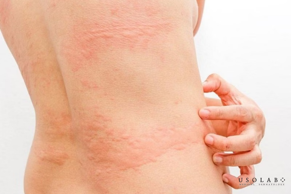 kem dưỡng trắng body cho da nhạy cảm
