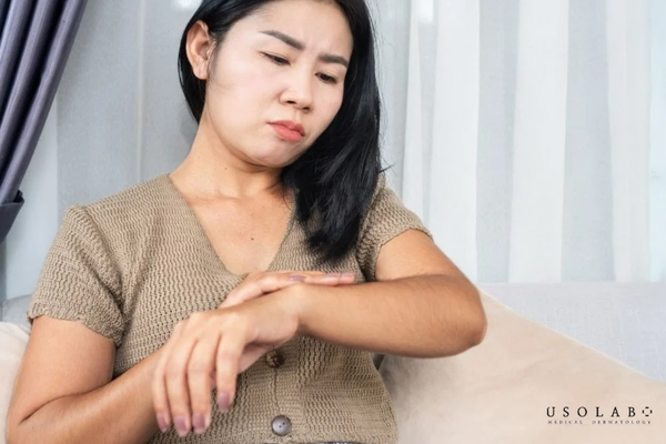 kem dưỡng trắng body không bét rít