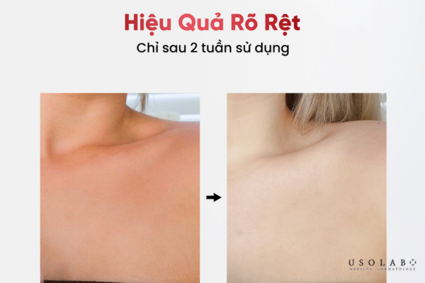 kem dưỡng trắng da body