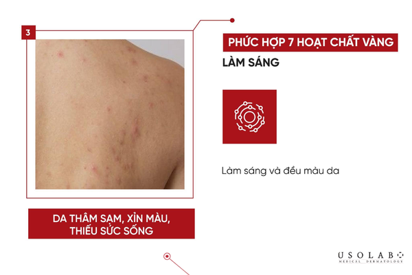 kem trắng da body