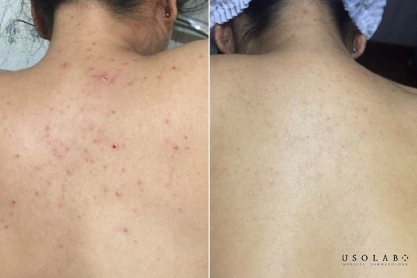 review kem body trắng da 2026