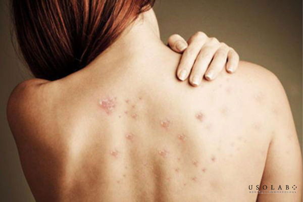 routine dưỡng trắng da body tại nhà