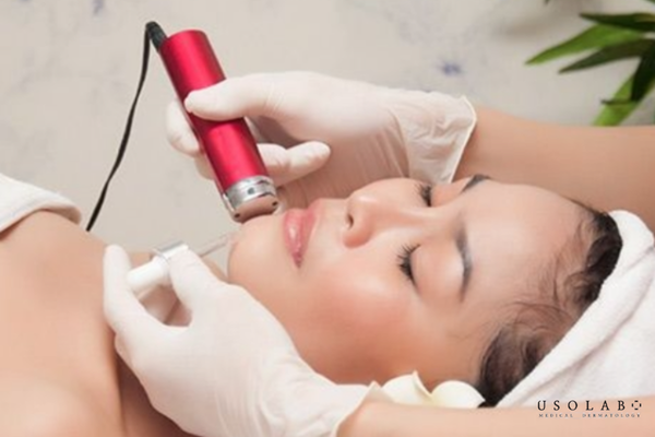 ủ trắng da mặt sau laser