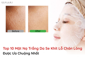mặt nạ trắng da se khít lỗ chân lông