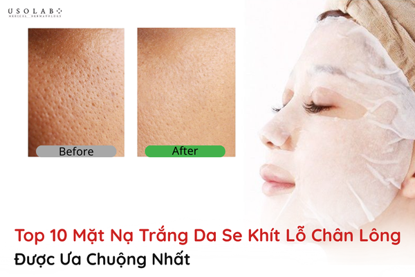 mặt nạ trắng da se khít lỗ chân lông