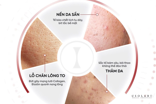 cách ủ trắng da mặt tại nhà an toàn
