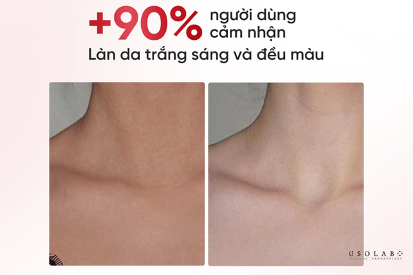 cách dưỡng trắng da body cho học sinh