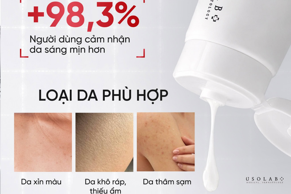 cách ủ trắng phục hồi da cháy nắng