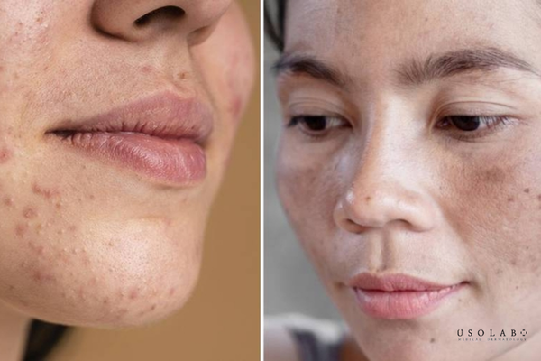 cách làm trắng da mặt xỉn màu bẩm sinh