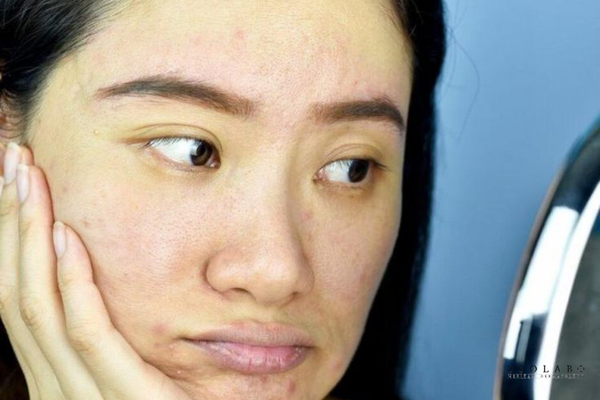 cách làm trắng da mặt xỉn màu bẩm sinh