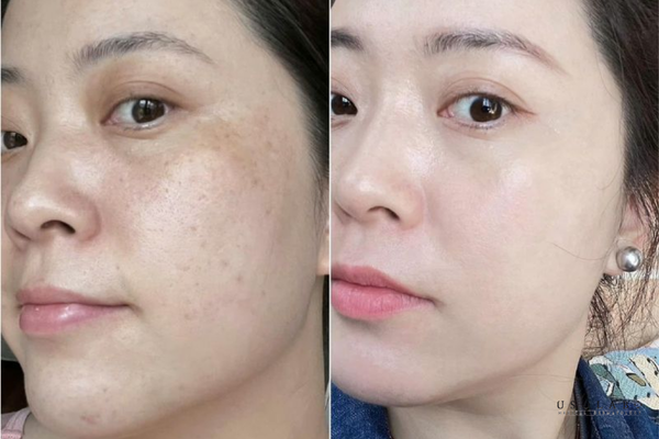 cách làm trắng da body cấp tốc tại nhà