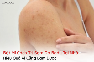 cách trị sạm da body tại nhà hiệu quả