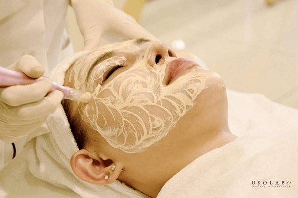 cấy trắng face và ủ trắng face cái nào tốt hơn