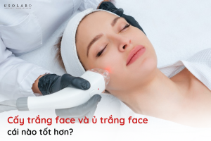 cấy trắng face và ủ trắng face cái nào tốt hơn